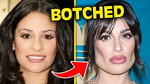 688K views · 2.4K reactions | Top 10 Celebrities Who Destroyed Their Looks With BOTCHED Plastic Surgery | Inform Overload | Facebook