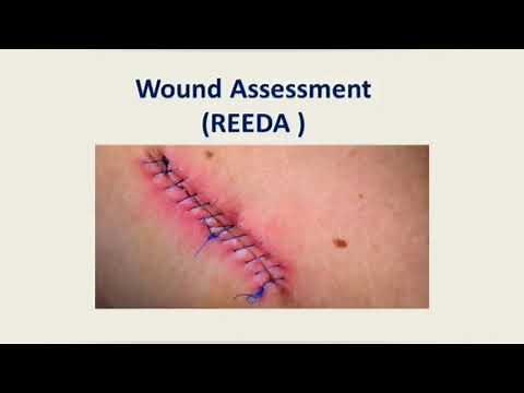 REEDA ASSESSMENT #Reedaassesment #postpartumassessment