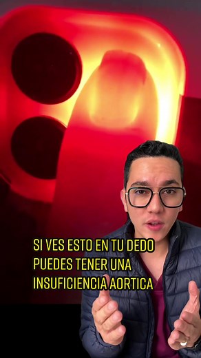 Si ves esto en tu dedo puedes tener insuficiencia aórtica | Signo de Quincke. #medicina #academia #educacion #doctorwilliamguerrero #signo #insuficienciaaortica #fyp #fypシ #parati #viral