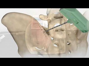 Magellan MAR0Max Training Video