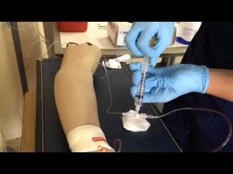 Arterial Line Vid