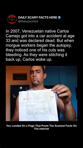 Thescaryfact ™ on Instagram: "In 2007, Carlos Camejo, a 33-year-old Venezuelan man, was declared dead following a car accident. But as morgue workers began his autopsy, they noticed that one of his incisions began to bleed — a clear sign of life. As they began to stitch him up, Carlos regained consciousness on the autopsy table. Authorities were left stunned, and Carlos later joked that he woke up in "tremendous pain" — but was grateful to be alive. The case remains one of the most surreal near-