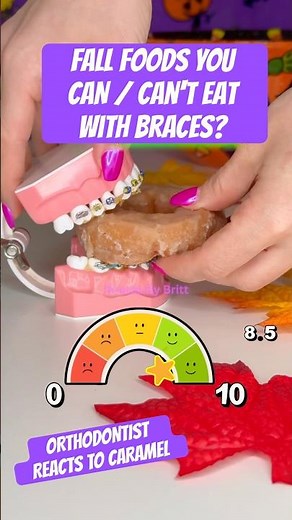 FALL FOODS YOU CAN / CAN'T EAT WITH BRACES ?! Orthodontist Reacts to Caramel #braces #candy #asmr