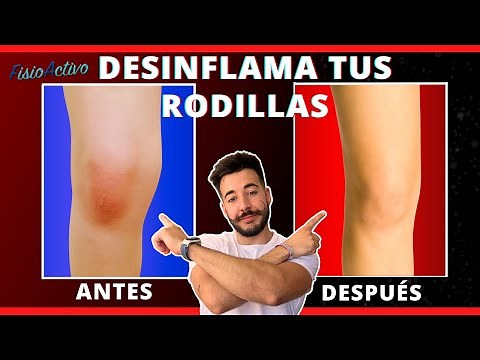 Cómo DESINFLAMAR LAS RODILLAS y eliminar el LÍQUIDO: Haz estos 5 EJERCICIOS