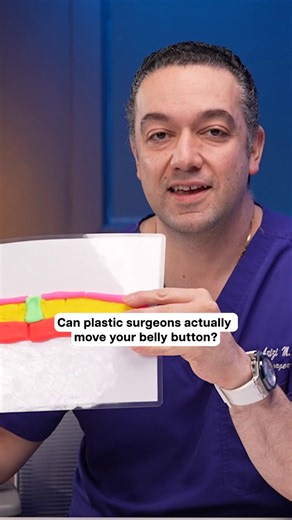 Belly button?🤔 #PlasticSurgery #BellyButton