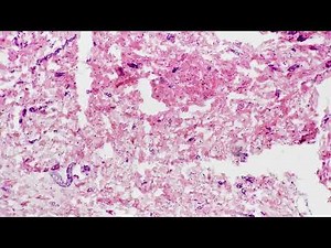 Smooth muscle of human being in longitudinal section filmed under microscope 100x on bright field