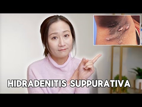Boils in your underarms? Dermatologist explains Hidradenitis Suppurative | Dr. Jenny Liu