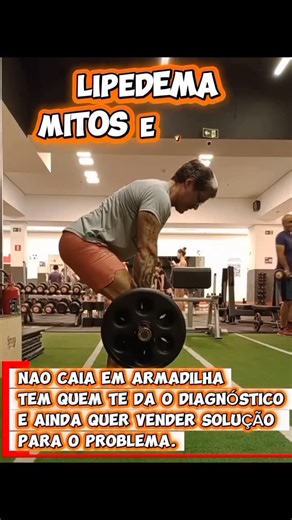 Pedro Almeida | Profissional de Educação Fisica on Instagram: "⚠️LIPEDEMA: MITOS E VERDADES: O lipedema é uma condição crônica que ainda gera muita desinformação. Vou esclarecer com base na literatura científica. ✅ VERDADE: Lipedema não é obesidade. O lipedema é um distúrbio crônico do tecido adiposo, com acúmulo desproporcional de gordura, principalmente em membros inferiores e, às vezes, superiores, geralmente poupando pés e mãos. (Wold et al., 1951; Herbst, 2012). ❌ MITO: É só falta de dieta 