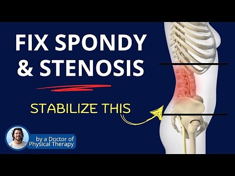 Fix Spondylosis & Stenosis with Core Engagement