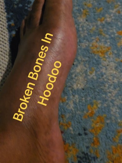 HOW TO HEAL BROKEN BONES IN HOODOO?? #hoodoo #fy #fyp #women #medicine | bones