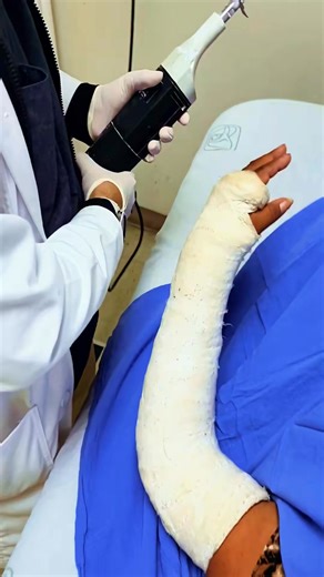 The Doctor Strange Help Poor Woman Removal Cast Arm In Hospital  #removal #cutting #castremoval #help #patients #doctorstrange #fyp #emotional #hospital #medical #brokenarm #brokenbone ##395 | Harish Shorts Reels | Facebook