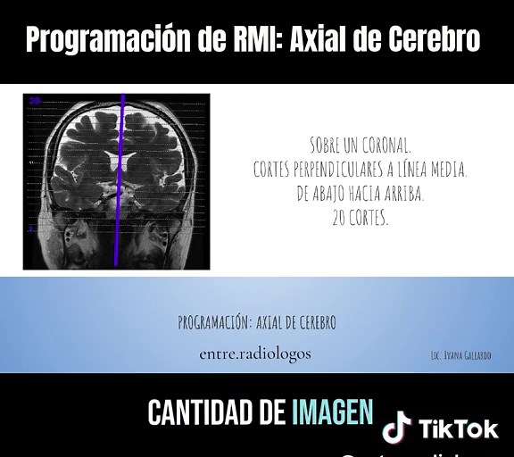 Curso de Resonancia Magnética: Programación RMI Axial