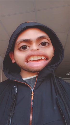 رياكت على السريع! هيفصلك ضحك 😉🔥