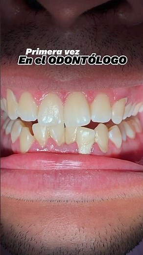 Ultrasonic dental cleaning for healthy gums and healthy teeth