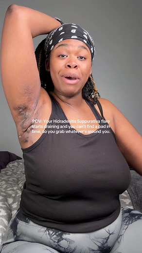 Managing Hidradenitis Suppurativa Flare-Ups