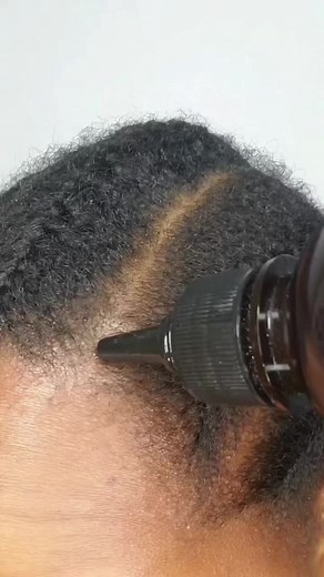 Chebe Extreme Growth Oil for Dry, Brittle Hair | Hair Loss, Receding Hairline, Dandruff-Prone Scalp