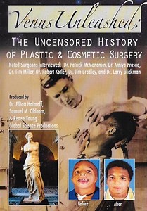 Venus Unleashed: The Uncensored History of Plastic & Cosmetic Surgery (2009)