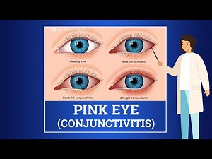 What is Pink Eye (Conjunctivitis)?
