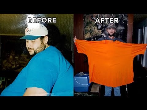 See Man’s Incredible Skin Removal Surgery After Losing 550 Pounds