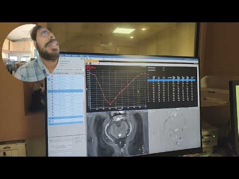 CSF Flow study ‪@Philips‬ 3T. post processing Video.Part-2‪@avnishradiology‬