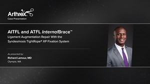 AIFTL and ATFL InternalBrace™ Repair With Syndesmosis TightRope® XP Fixation