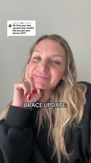 Replying to @alli 🐝 looking at the bright side that in 14 months my teeth will be perfect! #adultbraces #orthodontics #bracestips