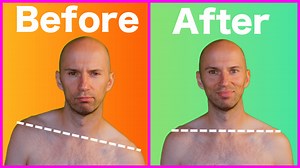 Why is My Left Shoulder Lower Than My Right? – Biomechanics and Treatment