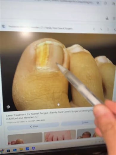 If you also encounter this situation, you can try this!