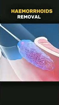 Kinesin Motor Protein Walking | Cell Biology 3D #Kinesin #CellBiology