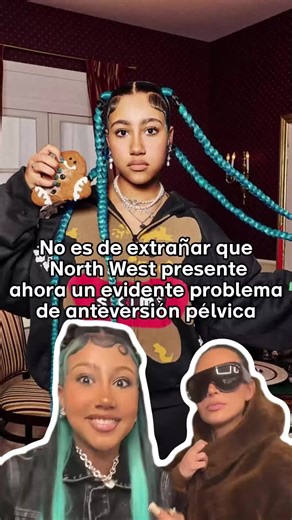No es de extrañar que North West presente ahora un evidente problema de anteversión pélvica#celebrity #usa #star #NorthWest #kimkardashian