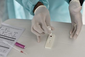 IgG positivo: entenda o que significa o resultado no exame de Covid-19