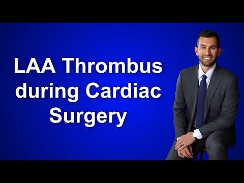 Left Atrial Appendage Thrombus During Cardiac Surgery: What Should You Do?