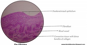 Oral Pathology Histopathological Diagrams - All in one - Histology made easy