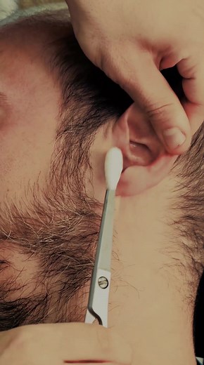 Fire Ear Cleaning ASMR: Turkish Barber Waxing & Ear Hair Removal