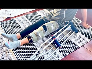 Restoration of an old private house. The landlady of the old house broke a bone.