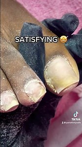 satisfying toe jam cleaning ✨
