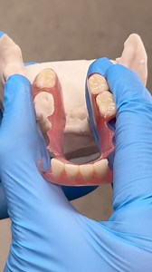 112K views · 589 reactions | Flexi Stress Test! Case from Dr. Chris Davenport in Virginia! | Luke Kahng | Facebook