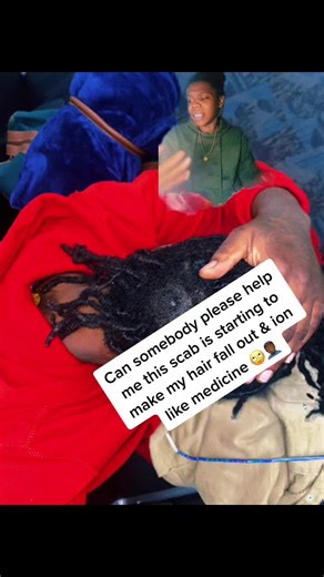 Dealing with Hair Scabs: Expert Advice for Black Hair and Locs