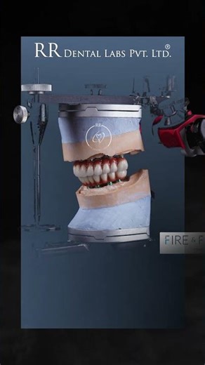 Its RR Dental lab- best dental lab in India