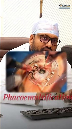 What is Traumatic Cataract? Causes & Treatment Explained by Eye Specialist | Netravedam Eye Hospital