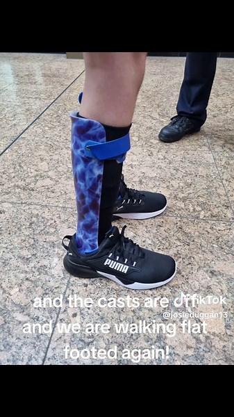 Emotional Journey Through 7 Weeks of Serial Casting