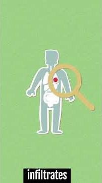 USMLE Step 1 Question of the Day - Lungs