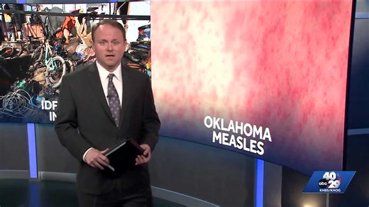Potential measles exposure reported at Oklahoma bar