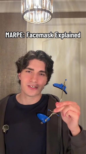 The reverse-pull facemask phase of my MARPE treatment has started. Here’s what it does, how it attaches, and how long I’m in it #marpe #expansion #orthodontics #facemask #headgear