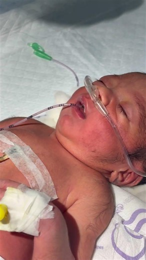 putting ogtu on newborn baby😭😭 #youtubeshorts #nursing #medical #newbornbaby #cutebaby #childbirth