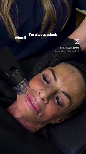 ✨ Next-level skin results: RF Microneedling Exosomes ✨ If you’re looking to improve skin quality, texture, and firmness — RF microneedling combined with exosomes is one of the most powerful treatments available. RF microneedling delivers controlled heat deep into the skin to stimulate collagen and elastin, helping to tighten, firm, and remodel the skin. When paired with exosomes, the skin’s repair and regeneration process is taken even further — enhancing healing, boosting results, and improving