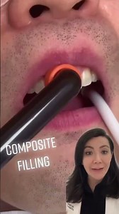 How do we treat a chipped tooth ?!