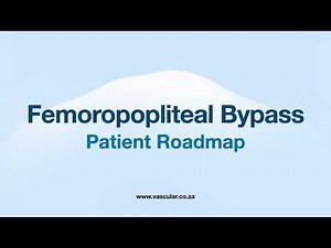 Patient Roadmap for Femoropopliteal Bypass Surgery