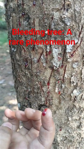 bleeding tree: A rare phenomenon🩸🌳
