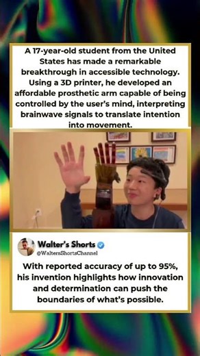 17-Year-Old Builds Mind-Controlled Prosthetic 🤯🦾